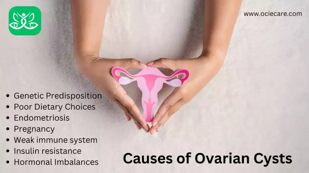 Causes of Ovarian Cysts