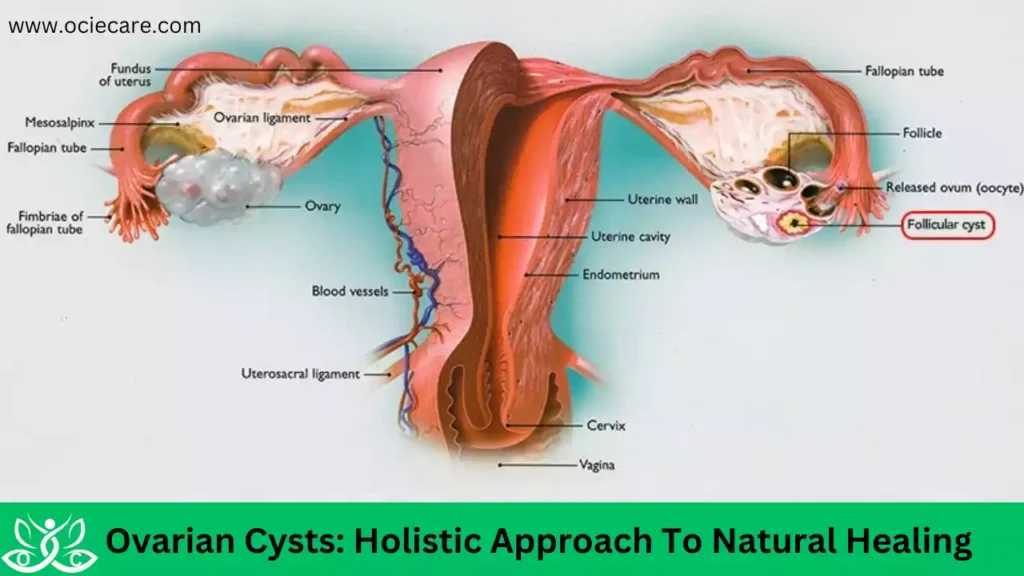 Understand Ovarian Cysts