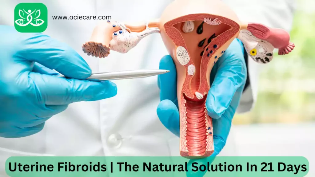 Uterine Fibroids | The Natural Solution In 21 Days