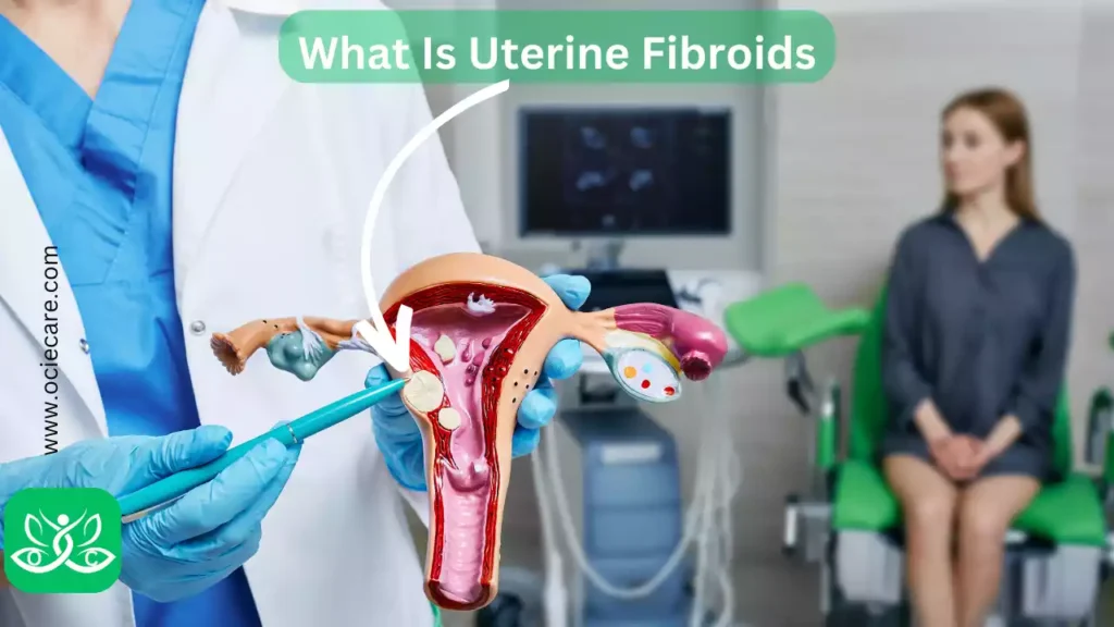 What Is Uterine Fibroids