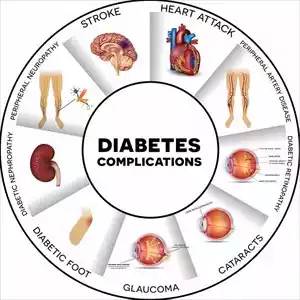 Blood Sugar | Diabetes: Understanding, Treatment, and Prevention In 2023