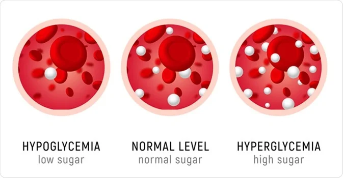 Blood Sugar | Diabetes: Understanding, Treatment, and Prevention In 2023