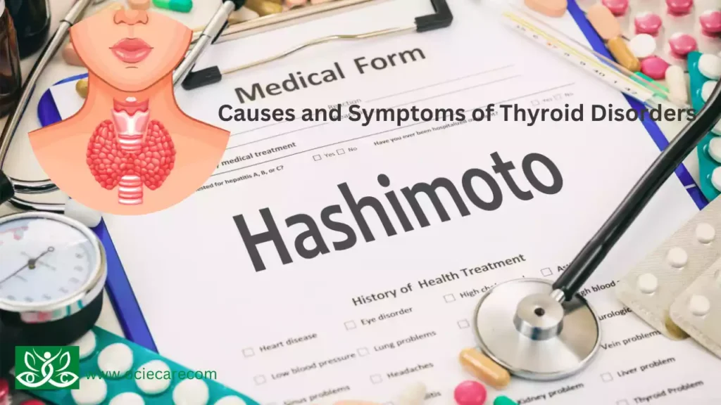 Causes and Symptoms of Thyroid Disorders