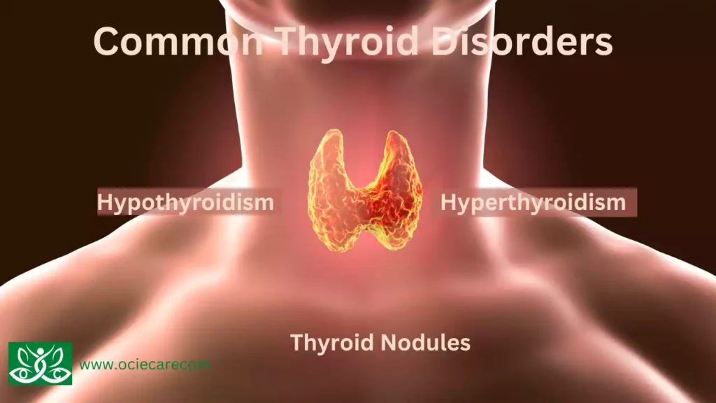 Thyroid Nodules