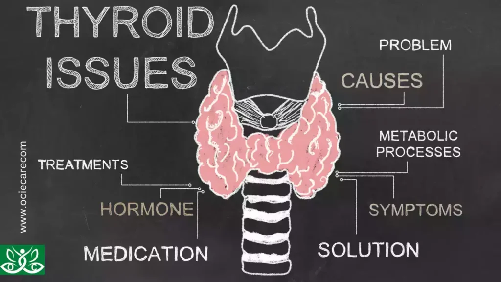 Introduction: The Intricacies of the Thyroid