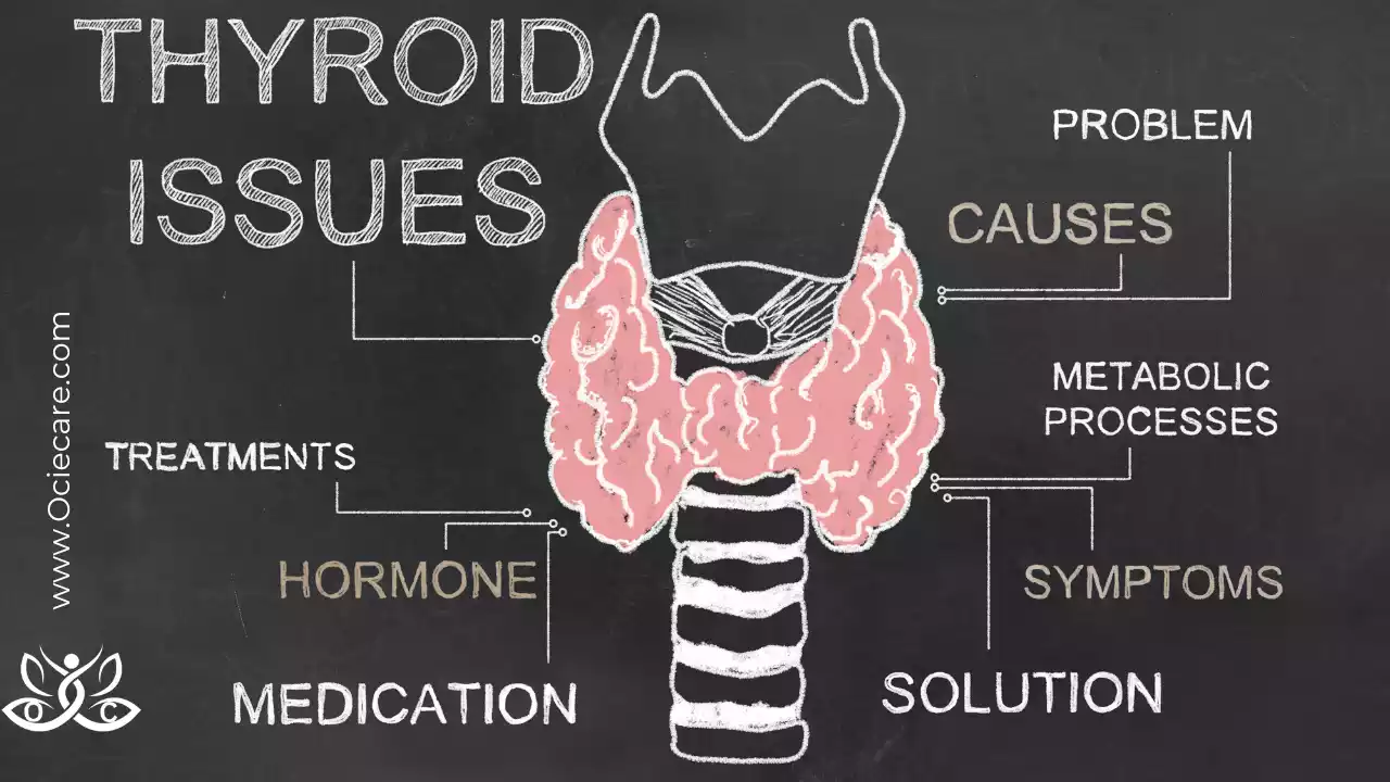 Treatment Approach of Subclinical Hypothyroidism icd 10