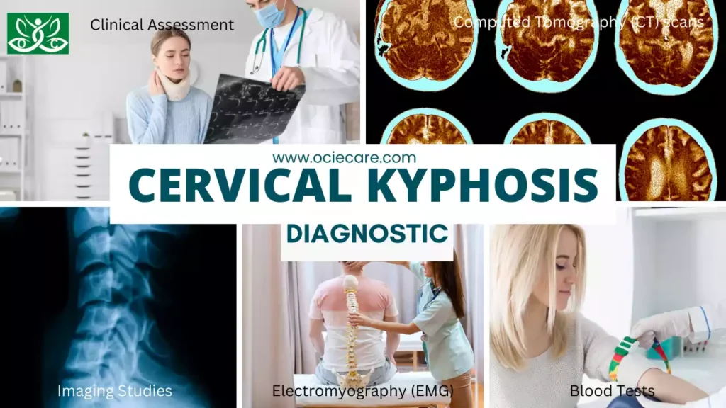 Cervical Kyphosis Diagnostic