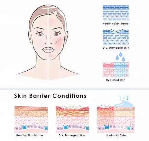 Hydrated Skin Diagram