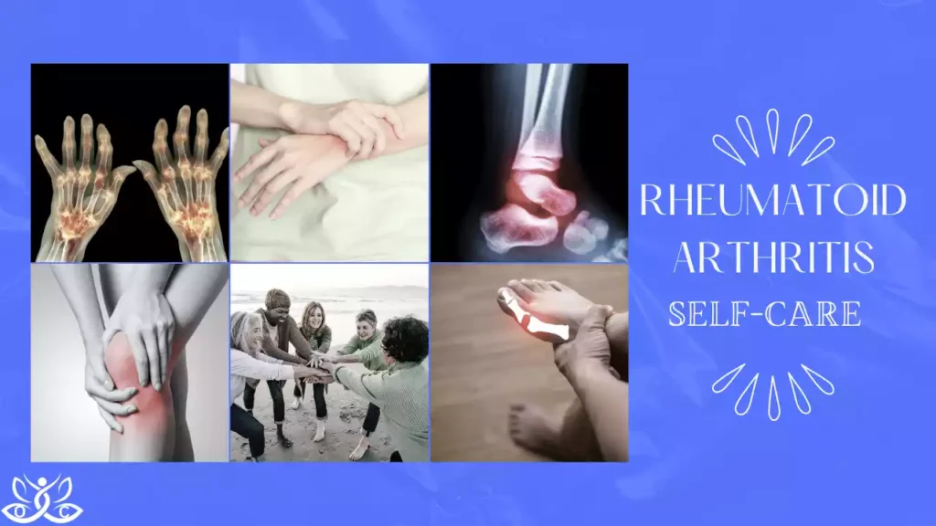 Rheumatoid Arthritis Self-Care