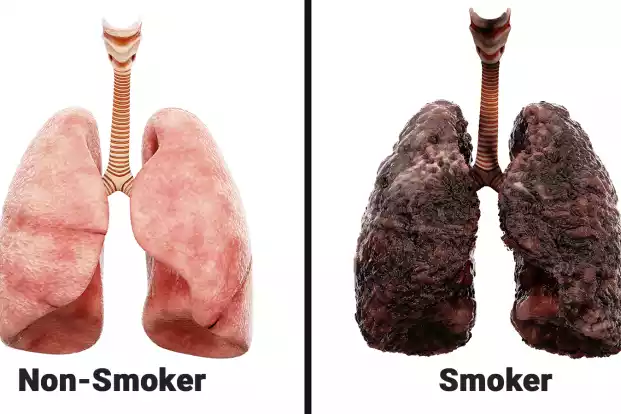 What-Smoking-Every-Day-Does-To-Your-Lungs